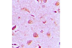 Immunohistochemical analysis of MAST3 staining in human brain formalin fixed paraffin embedded tissue section. (MAST3 抗体  (C-Term))