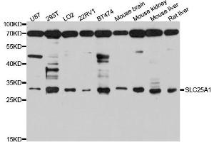 Western blot analysis of extract of various cells, using SLC25A1 antibody. (Slc25a1 抗体)