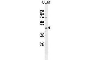 CCDC122 Antibody (C-term) western blot analysis in CEM cell line lysates (35µg/lane). (CCDC122 抗体  (C-Term))