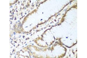 Immunohistochemistry of paraffin-embedded Human stomach using NUDT15 Polyclonal Antibody at dilution of 1:100 (40x lens).