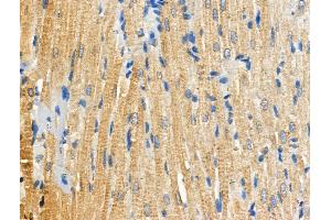 Phospho-RIPK3 (Ser227) Antibody at 1/100 staining Rat heart tissue by IHC-P. (RIPK3 抗体  (pSer227))