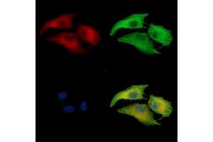 ABIN7095039 and ABIN7099095 staining  cells by IF/ICC. (NRAP 抗体)