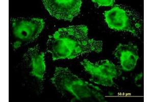 Image no. 1 for anti-Mitochondrial Ribosomal Protein L12 (MRPL12) (AA 1-199) antibody (ABIN598585) (MRPL12 抗体  (AA 1-199))