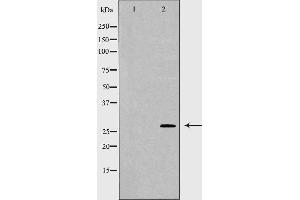 Western blot analysis of K562 whole cell lysates, using HLA-DQA1 Antibody. (HLA-DQA1 抗体)