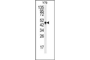 Image no. 1 for anti-Enolase 2 (Gamma, Neuronal) (ENO2) antibody (ABIN357943)