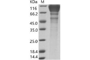 GP120 Protein (His tag)