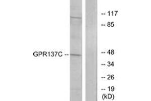 Western blot analysis of extracts from HepG2 cells, using GPR137C Antibody. (GPR137C 抗体  (AA 256-305))