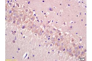 Formalin-fixed and paraffin embedded rat brain labeled with Anti-CECR5 Polyclonal Antibody, Unconjugated (ABIN872871) at 1:200 followed by conjugation to the secondary antibody and DAB staining. (CECR5 抗体  (AA 251-350))