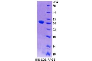 SDS-PAGE analysis of Mouse MYT1 Protein. (MYT1 蛋白)