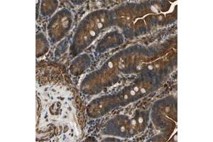 Immunohistochemical staining of human colon with ERGIC1 polyclonal antibody  shows strong cytoplasmic and membranous positivity in glandular cells at 1:20-1:50 dilution.