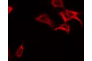 Immunofluorescence (fixed cells) (IF/ICC) image for anti-Met Proto-Oncogene (MET) (C-Term) antibody (ABIN6263230)