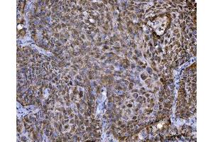 IHC analysis of TRBP/TARBP2 using anti-TRBP/TARBP2 antibody (ABIN7600548).