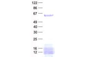 Western Blotting (WB) image for HIV-1 Rev Binding Protein (HRB) protein (His tag) (ABIN2714452)