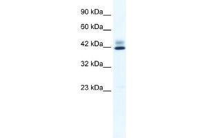 WB Suggested Anti-ZNF551 Antibody Titration:  0. (ZNF551 抗体  (N-Term))