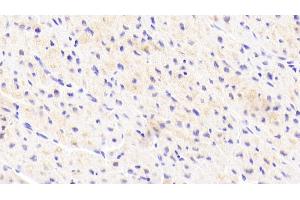 Immunohistochemistry (IHC) image for anti-Golgi Membrane Protein 1 (GOLM1) (AA 119-223) antibody (ABIN7433906)