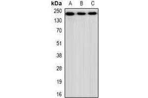 Western blot analysis of CHD4 expression in HEK293 (A), NIH3T3 (B), H9C2 (C) whole cell lysates. (CHD4 抗体)