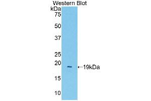 WB of Protein Standard: different control antibodies against Highly purified E.