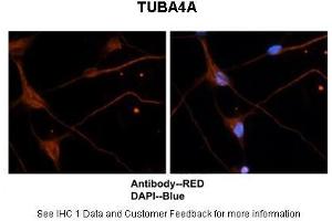 Immunohistochemistry (IHC) image for anti-Tubulin, alpha 4a (TUBA4A) (Middle Region) antibody (ABIN2778649)