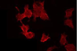 ABIN6272400 staining MCF7 by IF/ICC. (POTE-14/22 抗体)