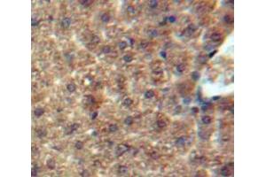Used in DAB staining on fromalin fixed paraffin-embedded Liver tissue (CCL7 抗体  (AA 24-99))