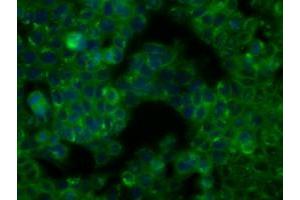 Image no. 2 for anti-Bruton Agammaglobulinemia tyrosine Kinase (BTK) antibody (ABIN1496974) (BTK 抗体)