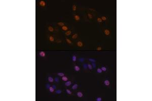 Immunofluorescence (IF) image for anti-Kinesin Family Member C1 (KIFC1) antibody (ABIN1680485)