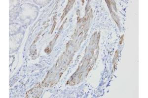 IHC-P Image Immunohistochemical analysis of paraffin-embedded human smooth muscle, using GOLGA5, antibody at 1:100 dilution. (GOLGA5 抗体)