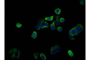 Immunofluorescence staining of MCF-7 cells with ABIN7163222 at 1:100, counter-stained with DAPI. (PIGQ 抗体  (AA 616-760))