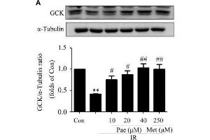 Paeonol regulated the phosphorylation of Akt and the protein contents of GCK and LDLR in insulin-resistant HepG2 cells. (GCK 抗体  (AA 1-300))