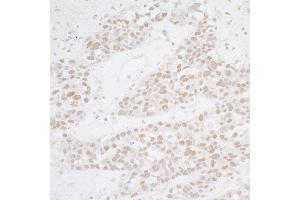 Immunohistochemistry (IHC) image for anti-Activating Transcription Factor 1 (AFT1) (AA 1-50) antibody (ABIN7454893)