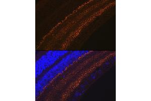 Immunofluorescence analysis of rat retina using G Rabbit mAb (ABIN7267515) at dilution of 1:100 (40x lens). (GAP43 抗体)