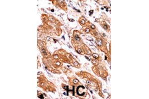Immunohistochemistry (IHC) image for anti-BCL2-Interacting Killer (Apoptosis-Inducing) (BIK) (pThr33) antibody (ABIN2970932) (BIK 抗体  (pThr33))