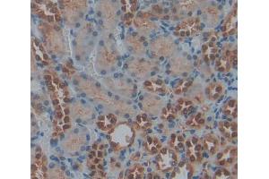 Used in DAB staining on fromalin fixed paraffin- embedded kidney tissue (PRKX 抗体  (AA 49-358))