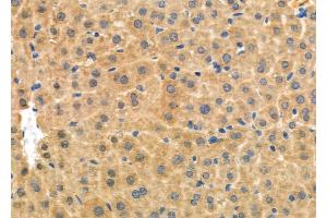 ABIN6264567 and ABIN6276965 at 1/100 staining Mouse liver tissue by IHC-P. (RAB27A 抗体  (C-Term))