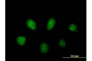 Immunofluorescence of purified MaxPab antibody to PARP3 on HeLa cell. (PARP3 抗体  (AA 1-533))