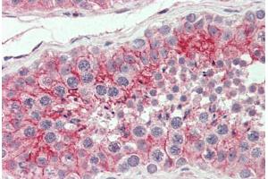 Anti-CXADR antibody  ABIN960759 IHC staining of human testis. (Coxsackie Adenovirus Receptor 抗体  (Internal Region))