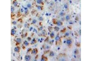 Used in DAB staining on fromalin fixed paraffin-embedded Liver tissue (Melatonin Receptor 1A 抗体  (AA 300-353))