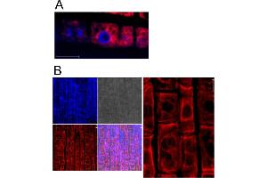 Image no. 2 for anti-Heat Shock 70kDa Protein 5 (Glucose-Regulated Protein, 78kDa) (HSPA5) antibody (ABIN349665) (GRP78 抗体)