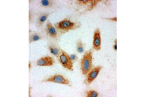 Anti-P cadherin antibody, ICC ICC: A549 Cell (P-Cadherin 抗体  (Middle Region))