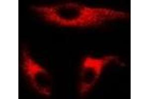 Immunofluorescent analysis of UBE2J2 staining in MCF7 cells. (UBE2J2 抗体)