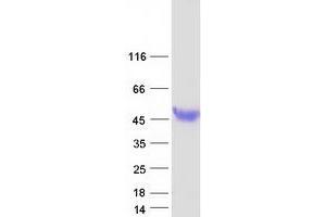 Validation with Western Blot