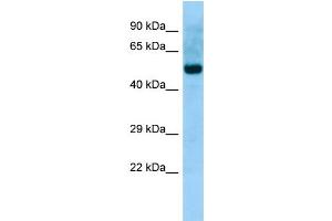 WB Suggested Anti-ABI2 Antibody Titration: 1.