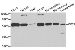Western blot analysis of extracts of various cell lines, using CCT2 antibody (ABIN5973929) at 1/1000 dilution. (CCT2 抗体)