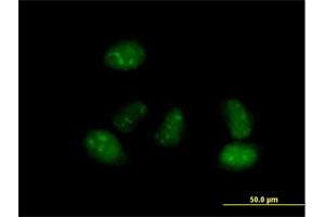 Immunofluorescence of purified MaxPab antibody to ALS2CR15 on HeLa cell. (ICA1L 抗体  (AA 1-482))
