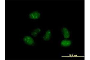 Immunofluorescence of purified MaxPab antibody to ALS2CR15 on HeLa cell. (ICA1L 抗体  (AA 1-482))