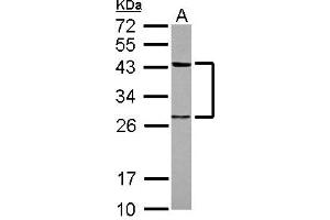 Western Blotting (WB) image for anti-Twinfilin, Actin-Binding Protein 1 (TWF1) (AA 14-208) antibody (ABIN1501587) (TWF1 抗体  (AA 14-208))
