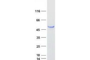 Validation with Western Blot