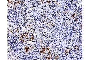 Immunohistochemistry (Paraffin-embedded Sections) (IHC (p)) image for anti-Integrin, alpha X (Complement Component 3 Receptor 4 Subunit) (ITGAX) antibody (ABIN7249394)
