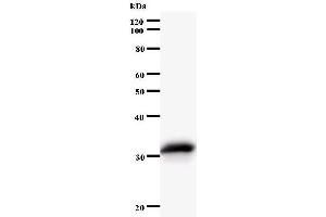 Western Blotting (WB) image for anti-N(alpha)-Acetyltransferase 15, NatA Auxiliary Subunit (NAA15) antibody (ABIN933132) (NAA15 抗体)