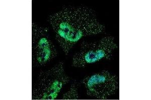 Confocal immunofluorescent analysis of HuR antibody with NCI-H460 cells followed by Alexa Fluor 488-conjugated goat anti-mouse lgG (green). (ELAVL1 抗体)